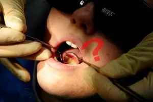 Ağız ve Diş Sağlığı Hakkında Enteresan Bilgiler